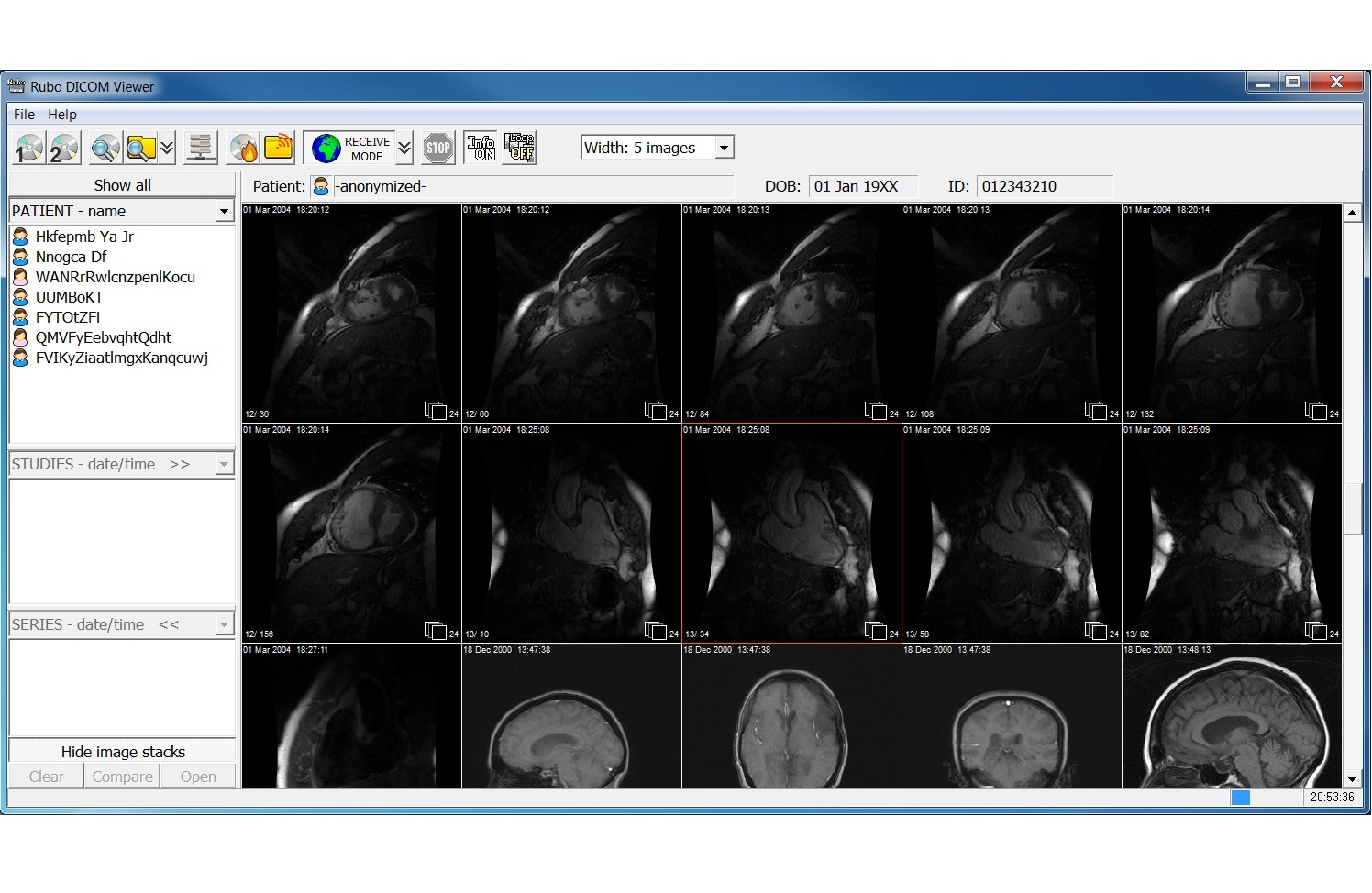 dicomdir file viewer dicomdir file viewer